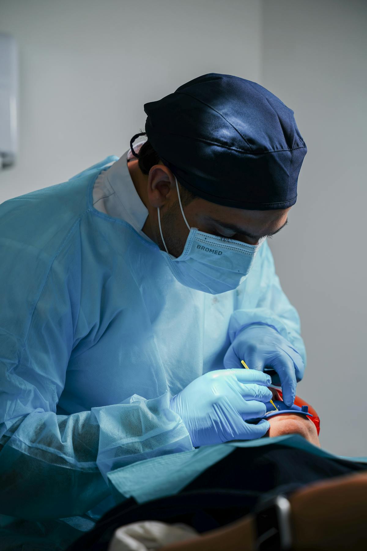 Afro Hair Transplant